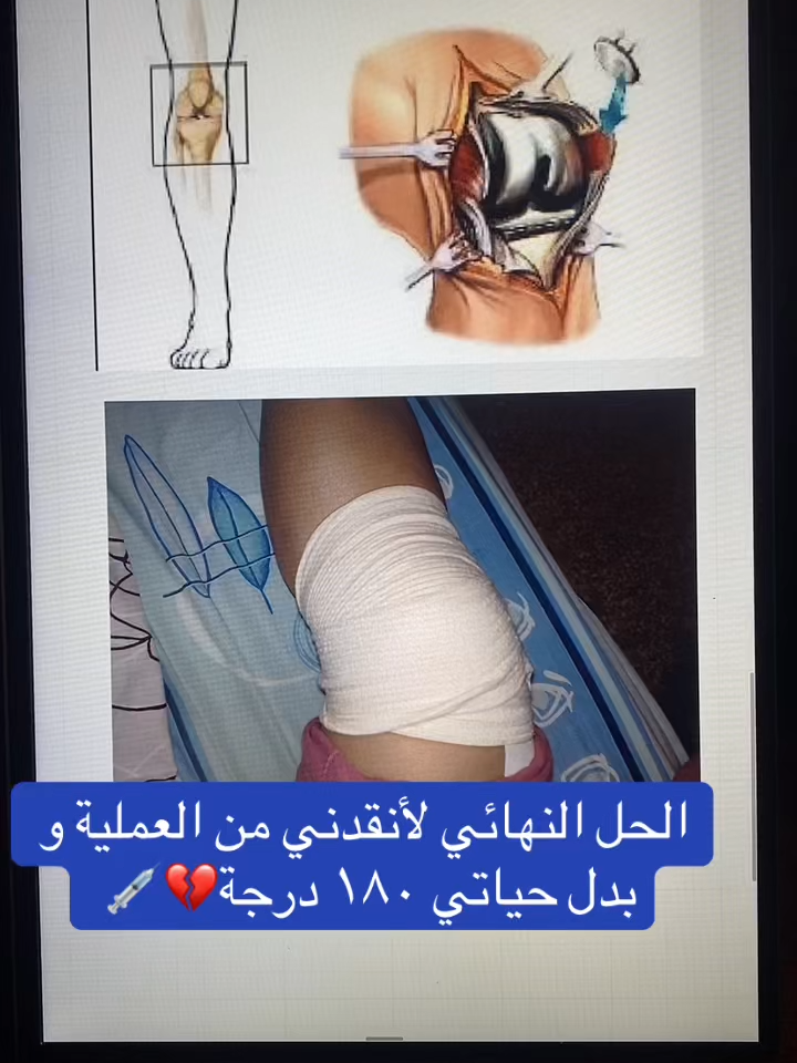 #التهابات_المفاصل_وغضاريف_الركبة #عرق_النسا #خشونة_الفقرات #خشونة_مفاصل_الركبة #خشونة_المفاصل #المدينة_المنورة #الدمام_الخبر_الاحساء_الجبيل_الظهران #الدمام_الخبر_الشرقيه_الاحساء_الهفوف #الرياض_الان_ #السعودية #اليوم_الوطني #الرقبة #جدة_الان #اليوم_الوطني_السعودي_94 #مكه #ألم #اليوم_الوطني_السعودي_٩٤