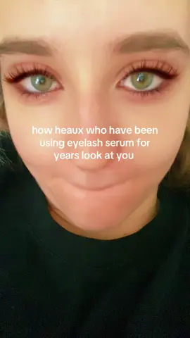 girl that eyelash serum is COOKING ur eye skin 😭😭😭😭 u got permanent red eyes that skin translucent. but lashes tea tho #eyelashserum #lashserum 