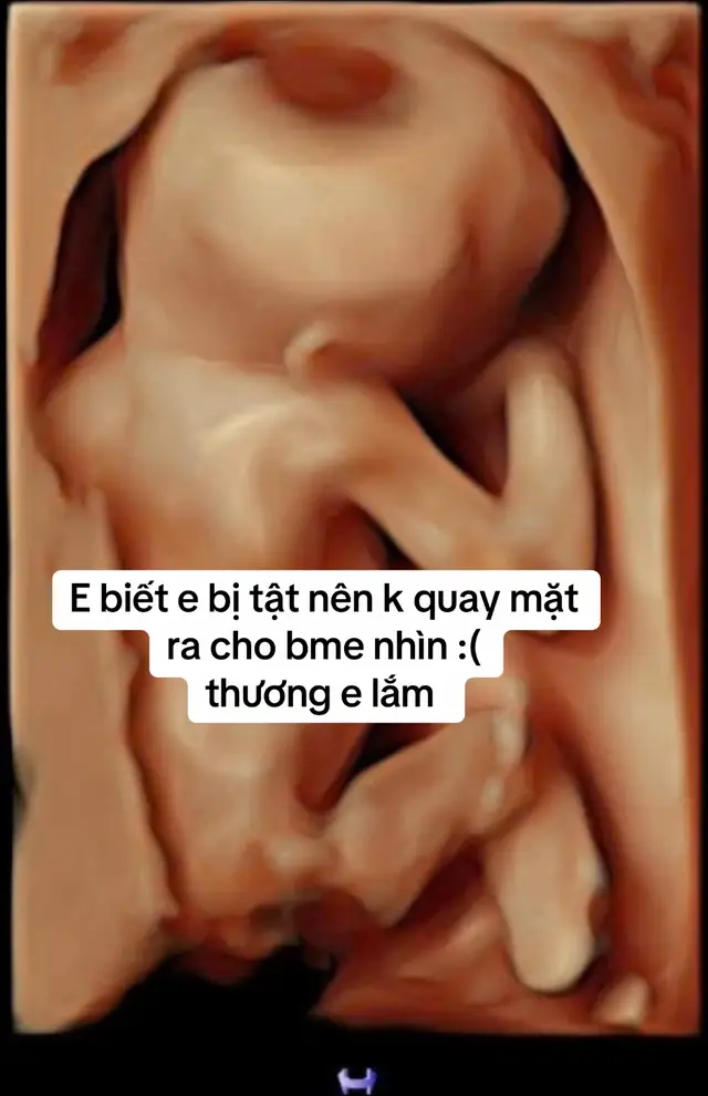 Siêu âm nước mắt bme rơi rất nhiều, thương em 😔 #mẹbau #mangthai 