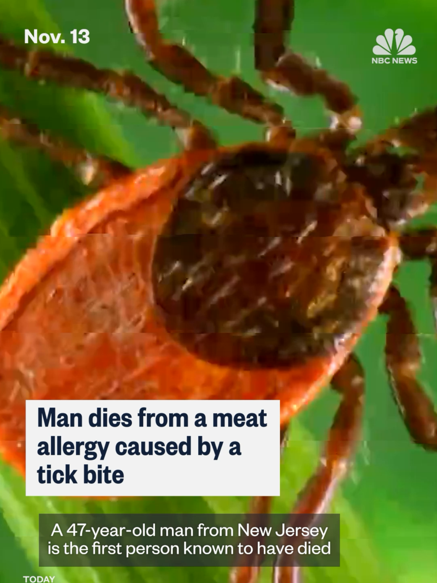 A 47-year-old from New Jersey is the first person known to have died from alpha-gal syndrome, a red meat allergy caused by a tick bite. Officials believe there are 450,000 Americans living with this tick-induced allergy.