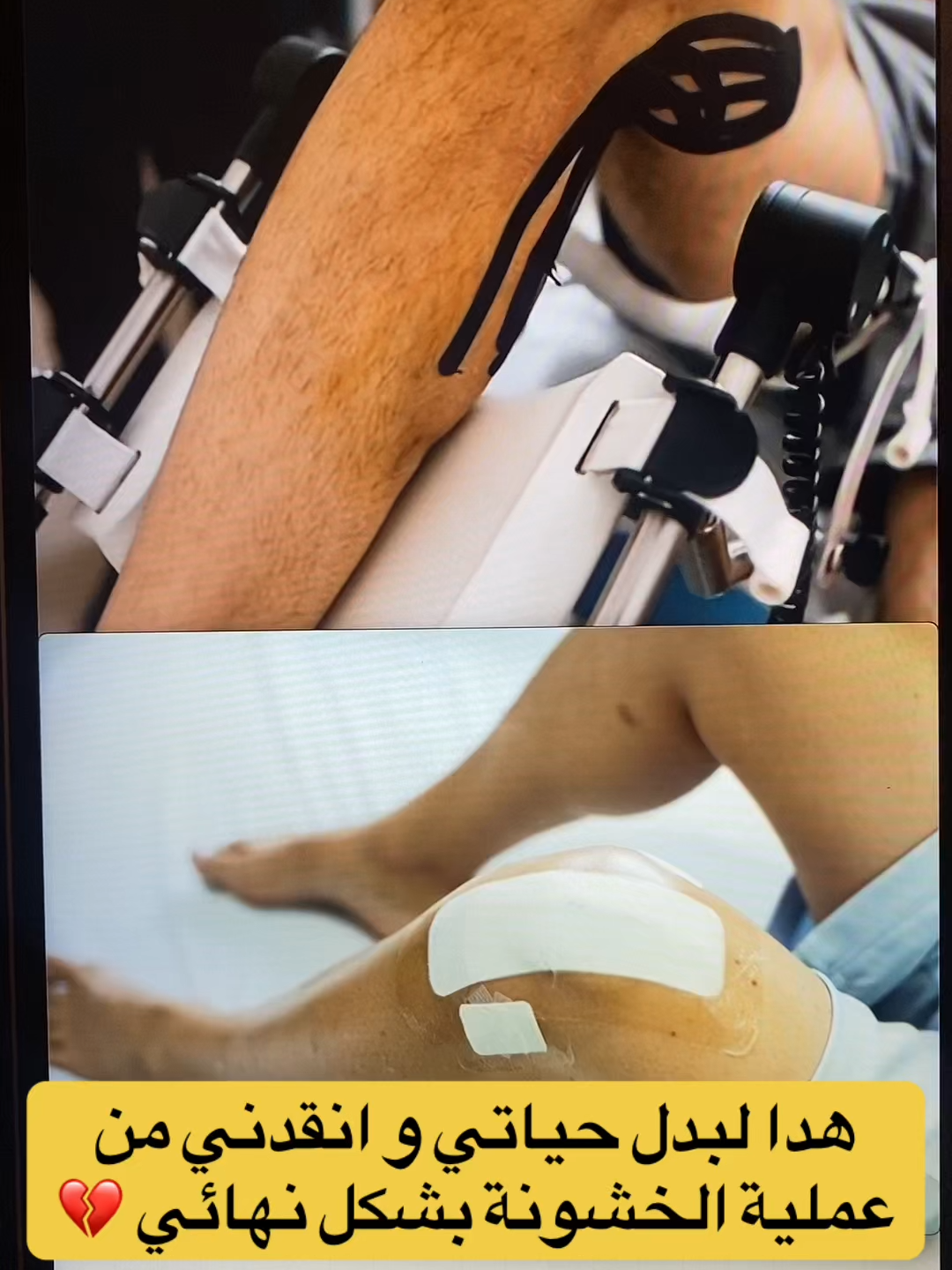 #خشونة_الفقرات #خشونة_مفاصل_الركبة #خشونة_المفاصل #المدينة_المنورة #الدمام_الخبر_الاحساء_الجبيل_الظهران #الدمام_الخبر_الشرقيه_الاحساء_الهفوف #التهابات_المفاصل_وغضاريف_الركبة #عرق_النسا #الرياض_الان_ #السعودية #اليوم_الوطني #الرقبة #جدة_الان #اليوم_الوطني_السعودي_94 #مكه #ألم #اليوم_الوطني_السعودي_٩٤