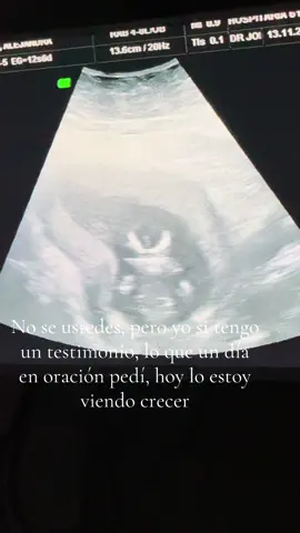 Dios con nosotros quien contra nosotros. #bebeencamino #GraciasDios #fyp #parati #ecografia @Alej Ascacio 