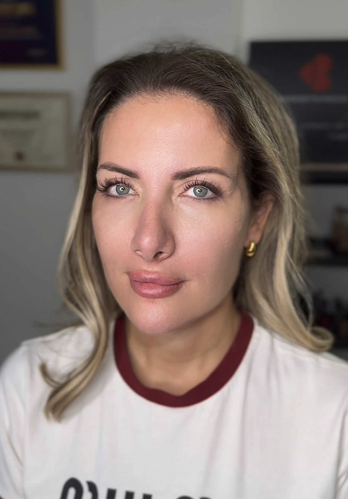 Non-surgical FULL FACE