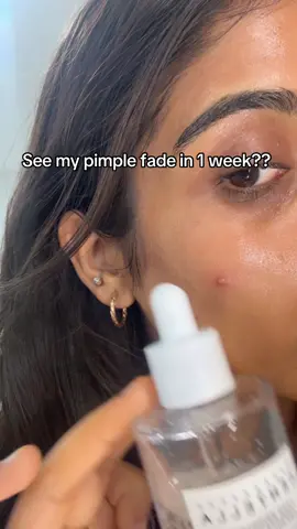 Watched my big pimple fade like magic using @SKIN1004 US  Tone Brightening Ampoule got my glow glowing . I got mine from @YesStyle @YesStyleInfluencers . #skincare #koreanskincare #skin1004 #pimplesolution #microinfluencer 