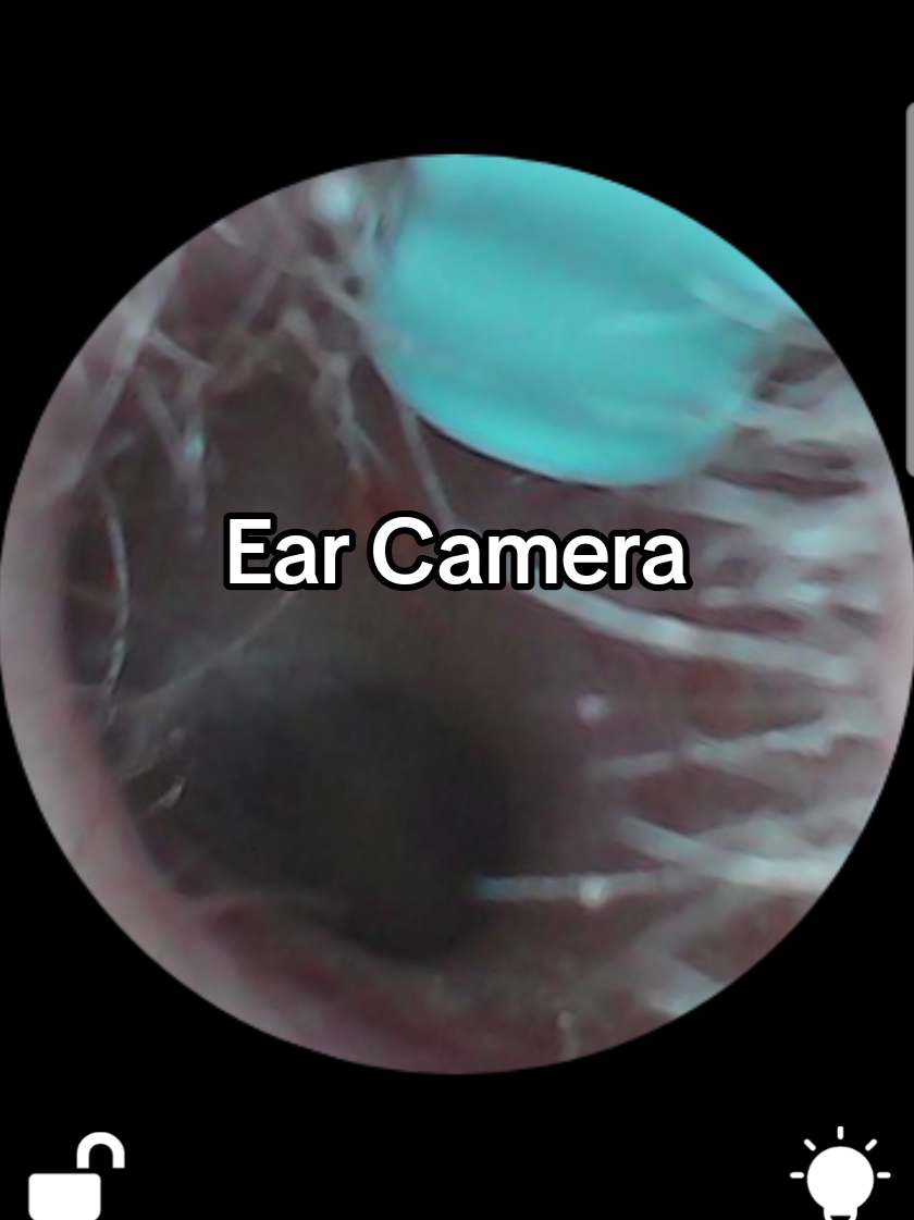 👂 SMART EAR WAX REMOVAL CAMERA — 1080P LED OTOSCOPE 🔍✨ See exactly what you’re doing with this 1080P HD ear cleaner, complete with a built-in LED otoscope camera that connects straight to your iPhone, iPad, or Android. The soft silicone tip makes it safe for adults and pets, and the live video feed helps you remove wax safely and confidently. Perfect for anyone who wants cleaner ears, clearer vision, and a smart upgrade to their routine. #earcleaningtool  #earwaxremoval  #otoscope  #tiktokshopblackfriday #earcamera 
