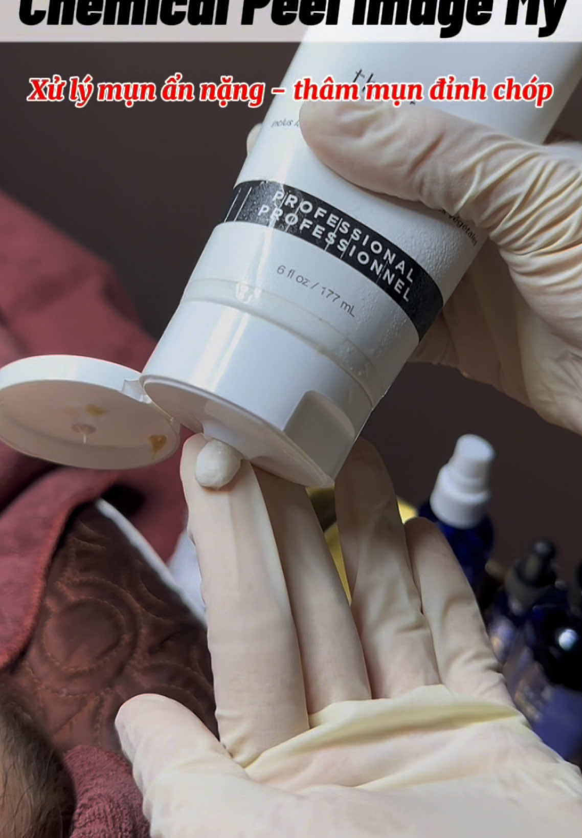 Chăm sóc da #chamsocdamun#chamsocdaseo#chamsocdanam#tanbinh#Lqspa 