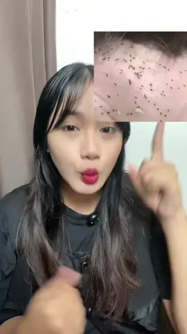 Pokonya jangan anggap sepele semua jenis kutu ya yang ada di anabul ya!! #catlover #fy #kutu 