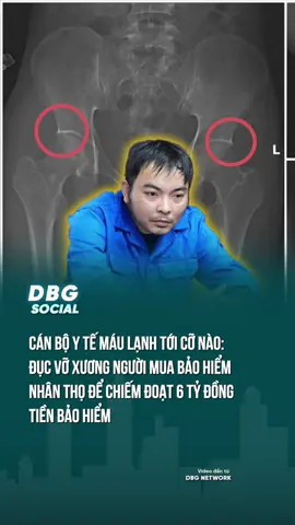 Cứ tưởng là kịch bản phim kinh dị cho tới khi tai nghe mắt thấy #DBGSocial #ducxuong #taminhchau