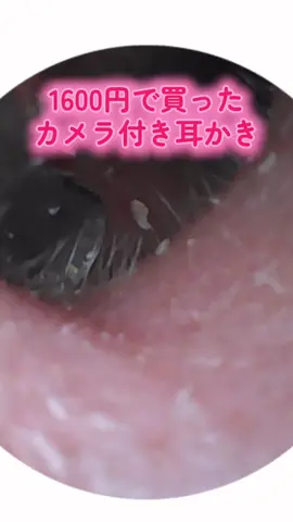 TikTokショップで買ったカメラ付き耳かきで鼓膜覗いてみた🫣#カメラ付き耳かき #耳掃除後でもまだ残ってるのわかる