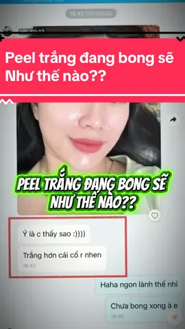 Peel trắng đang bong sẽ  Như thế nào??#túdoli #mixpeel #peeltrắng #trắngda #ủtrang 