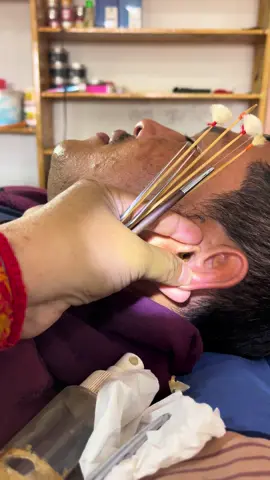 #ear #usa #cleaning #removal #remodel 