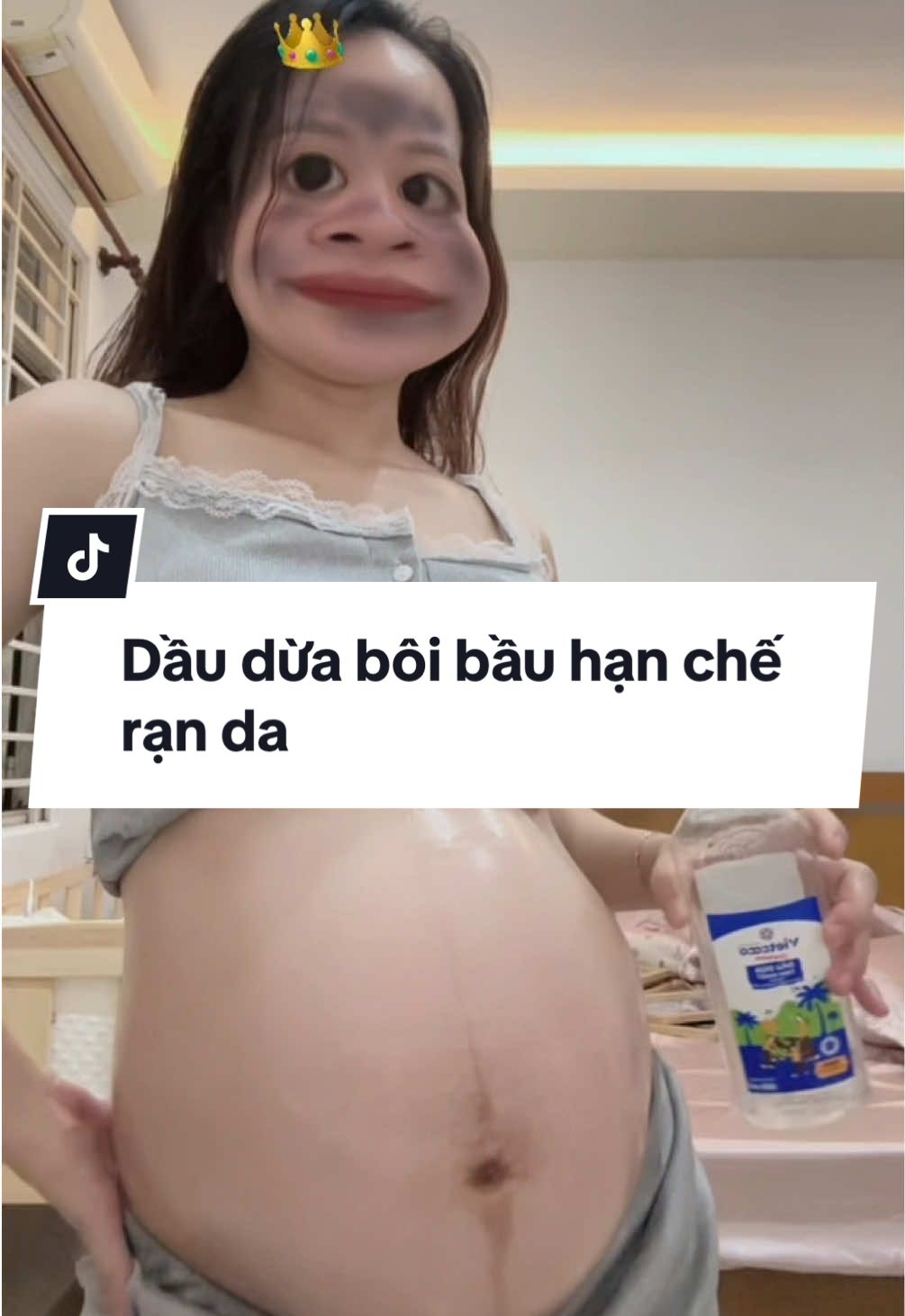 Được bà chị ck mách sài cái này á mấy bà. Tui biết là rạn da 1p do cơ địa, cơ mà có sài vẫn hơn. Nhưng thay vì sài những loại kem trên thị trường vừa mắc vừa không biết có hiệu quả hay không. Thì tui chọn dầu dừa. Công dụng chính cũng chỉ là dưỡng ẩm, lỡ sau này gần sinh có ranh thì tới đó tui sài kem đặc trị để bôi vết ranh đó sau. Còn mình cứ ưu tiên dưỡng ẩm da khi chưa có vết rạn nào nha ❤️❤️ #mebau #bau #kemranda #kemboibau #daudua 