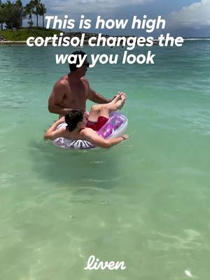 Chronic stress and high cortisol levels contribute to rising rates of anxiety.