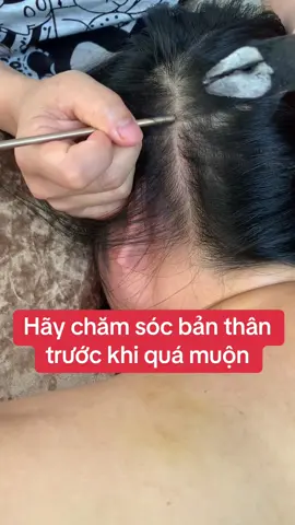 Đau đầu mất ngủ ,  stress , rối loạn tiền đình hãy chăm sóc não bộ nhé #duongsinh #daudau #phongnguadotquy #spa 