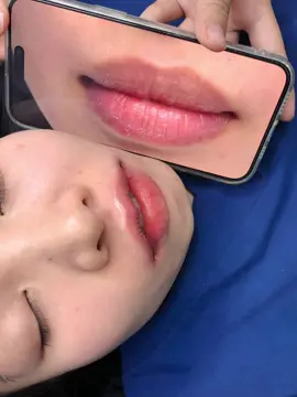 Cắt tạo hình môi đẹp tại Bắc Ninh #xh #bacninh #catmoi #cắtmoidep #sửamoiloi 