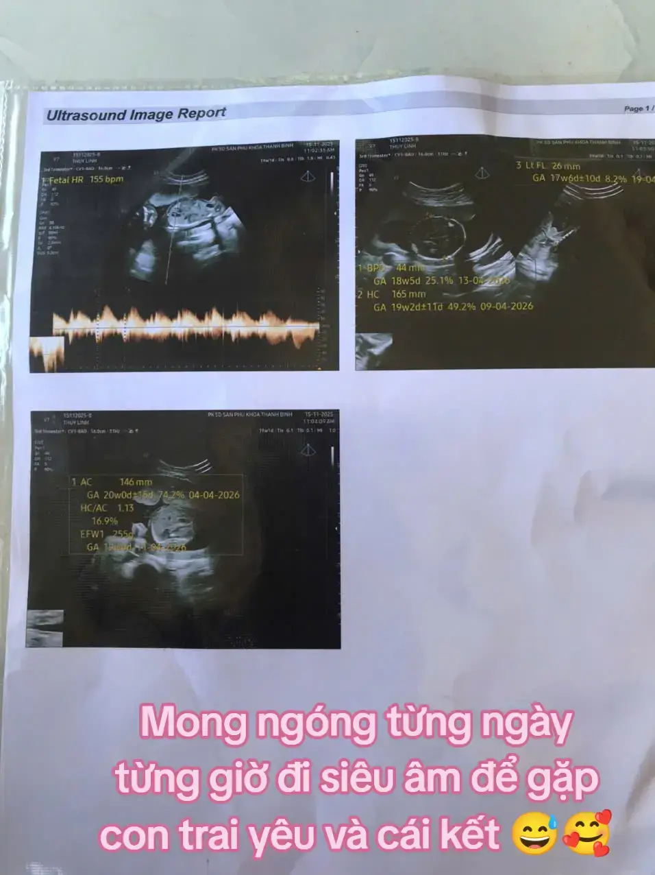 Mong ngóng từng ngày từng giờ đi siêu âm để gặp con trai yêu và cái kết 😅🥰 Nay trai yêu của mẹ được 19w1d rồi đó ,bám mẹ thật chặt nhé chàng trai hai của mẹ,mẹ con mình cũng nhau cố gắng nhé 🫄🐴👼👶 nhã vía 2vạch chim non 🐦 bỏ bụng cho mom nào đang mong con trai yêu nhé 🥰 #mẹbầu #nhãvía2vạch #đồngbầutháng4 #mộtthaikỳkhoẻmanh #2025 