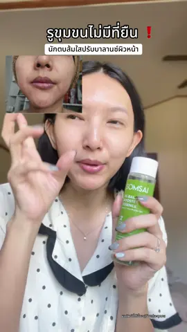 จากใจคนรูขุมขนกว้างเลยนะ #SOMSAI #เป็นสิวต้องส้มใส #ส้มใส16ปี #สบู่น้ำส้มใส #ผิวติดสาร 