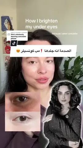 #undereyecircles #undereyeserum #undereyecare #beauty