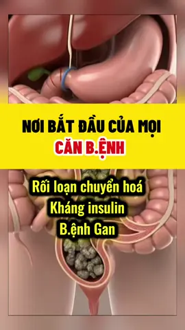 Nơi bắt đầu của mọi b.ệnh tật #health #suckhoechuyenhoa #LearnOnTikTok #detox #ruot 