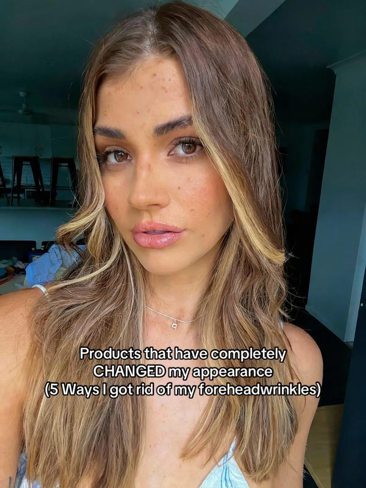 #beautytips #koreanskincare #acnetreatment #GlowUp #foryoupage 