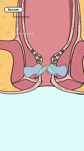 why you shouldn’t sit on the toilet for too long?