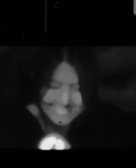 *کبھی کبھی دل کرتا ہے کہ جا کر اس کے قدموں میں گر جاؤں اور اسے چیخ چیخ کر بتاؤں کہ نہیں رہا جا رہا تمہارے بغیر*۔  *مت دو مجھے اتنی اذیت، یہ اذیت چوبیس گھنٹے میری آنکھوں میں آنسو بن کر رہتی ہے۔* *میرا دل کرتا ہے کہ کبھی وہ میرے سامنے بیٹھے مجھ سے حال پوچھے اور دیکھ کر کہے یہ تم نے کیا کر دیا خود کو۔* *میں اپنے دل کی ہر بات اسے بتا کر کہوں، تیری جدائی ختم کر دے گی مجھے، مت جاؤ۔*  *اور وہ میرے آنسو صاف کر کے کہے پاگل کہیں نہیں جا رہی میں، دیکھو میں تمہارے پاس ہی ہوں۔*  *ہائے افسوس مگر وہ نہیں ہے میرے پاس۔💔🥹* ι❤‍🩹🥹#fyp #viralvideo #trandintiktoksadvideo ہر کوئی جدائی سے مر نہیں جاتا کچھ لوگ زندہ رہے کر خود کو روز مارتے ہیں 💘🥀😭💔💯#brokenhurt💔💔💔_sad_alone😥😭 