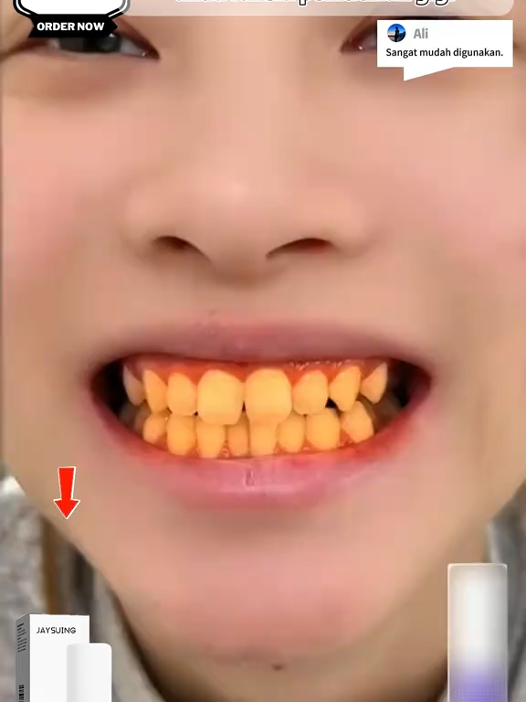 🌟Say goodbye to dental problems and hello to a fresh smile!🌟 Purple cleaning toothpaste removes stains and bad breath for long-lasting freshness! 💜 Clean and whiten in one go! #FreshBreath #StainRemoval #DeepClean #OralCare #HealthySmile