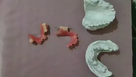 Gigi palsu lepas pasang sebagian Sesuai  premenkes Akrikc Hc #lpasanggigipalsulepasan #gigipalsuakrilik #tasikmalaya #4u #viral 