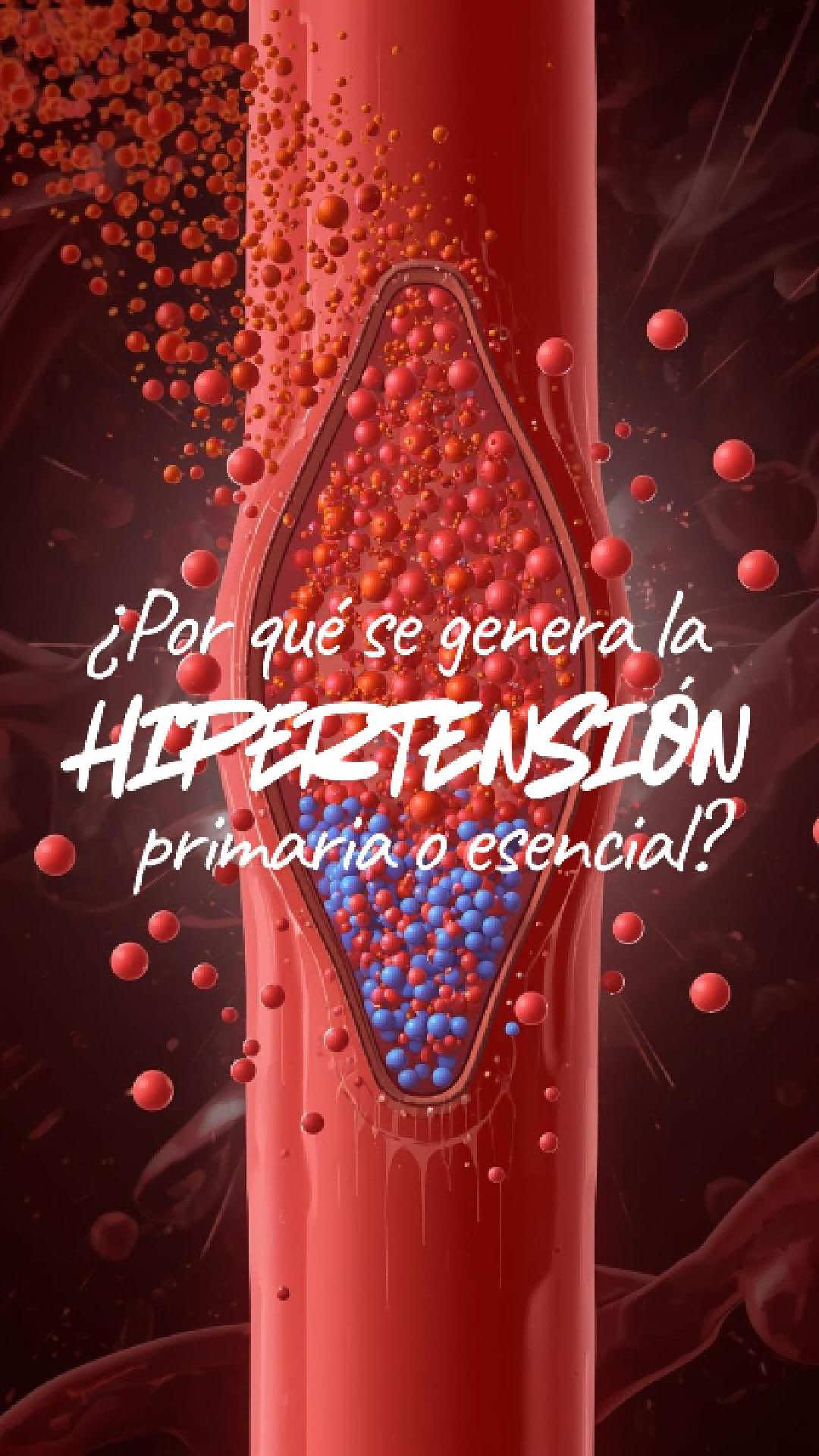 ¿Por qué tienes HIPERTENSIÓN primaria o esencial? 🫀
 
 Te diagnosticaron.
 Te dieron pastillas.
 Pero nadie te explicó el POR QUÉ.
 
 La hipertensión NO aparece de la nada.
 Es tu cuerpo diciéndote: algo está desbalanceado.
 
 LAS 4 CAUSAS PRINCIPALES:
 
 1️⃣INFLAMACIÓN CRÓNICA
 Estrés + mala alimentación + poco sueño = arterias inflamadas = presión alta
 
 2️⃣RESISTENCIA A LA INSULINA
 Exceso de azúcar y carbohidratos → tu cuerpo deja de responder bien → presión sube
 
 3️⃣ESTRÉS CRÓNICO
 Cortisol elevado → corazón trabaja más fuerte → arterias contraídas
 
 4️⃣DESBALANCE SODIO/POTASIO
 No es solo 