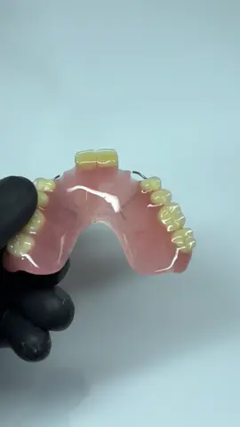 akrilik denture #gigi #gigipalsulepasan #gigipalsu #akrilik #bogor 