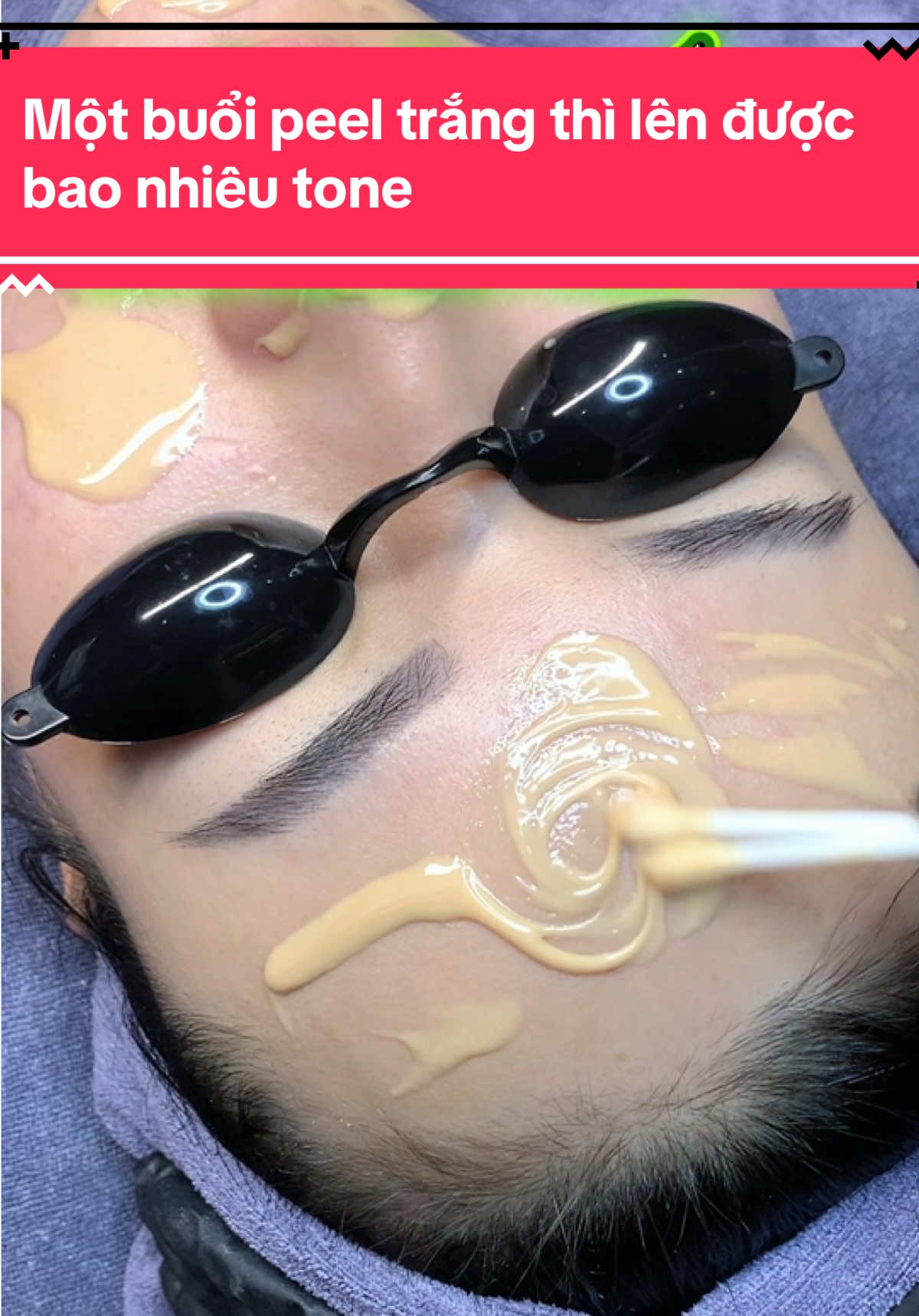 Một buổi peel trắng thì lên được bao nhiêu tone#túdoli #mixpeel #peeltrắng #ủtrang #trắngda 