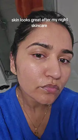 skin looks so healthy #skin #texture #nofilter #pores #healthyskin 