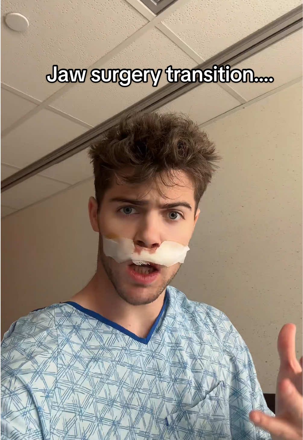 Honestly looks the same except my teeth #underbite #jaw #surgery