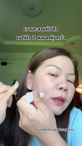 เจลละลายสิว #สิวอุดตัน #เมดิต้า #tiktokshopbeautyfestth 