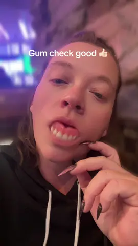 Always have healthy gums. You’re welcome #dentures #dentureconfidence #denturesatayoungage #toothless #denturejourney 