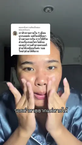 ตอบกลับ @bleuethurs อยากป้ายยาสิ่งนี้ #สิว #รักษาสิวด้วยตัวเอง #น้ําตบเลม่อน #น้ําตบลานอส #รอยดํา 
