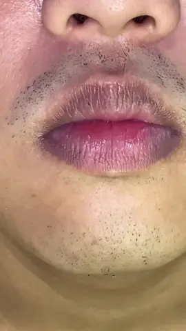 You think waxing is just for women? Think again!🩷 🏷️: @RECKITT STORE PH  #VeetPH #fyp #bodyhairremovalcream #easyhairremoval #ReckittStorePH 