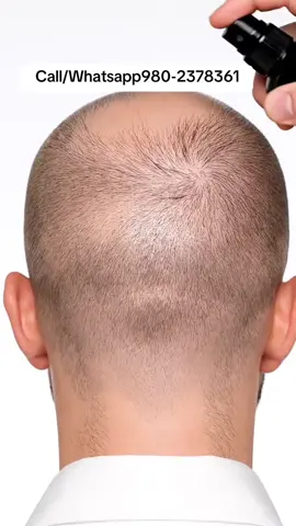 #hairfall #foryoupage #creatorsearchinsight #hairstyle #muser 