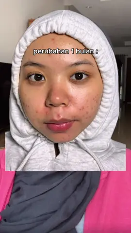 tor monitor ketua anggota mau lapor ketua #mugwortgelmaskg2g #acnegelmaskviral 