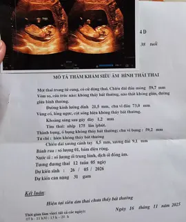 Ngựa🐴 con nay được 12 tuần 5 ngày rồi.Biết em giống mẹ mà mẹ mừng quá,luôn mạnh khỏe và xinh xắn nhé con yêu🥰 #thaikykhoemanh #thai12tuan #embengua2026 #bégai 