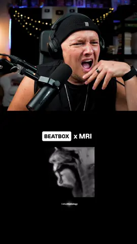 What 😳 Beatbox in a real time MRI! Timo Schnepf  #beatbox 