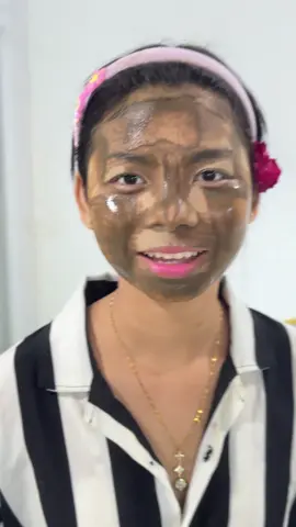 ပါးစပ်ဟမရတော့ဘူးတဲ့😁#တစ်ခဲ၅၀၀၀ #ViberPh09766006896မှာဆက်သွယ်မှာယူလို့ရပါတယ်ခင်ဗျာ💗 #on4t #foryoupage❤️❤️ #fypシ゚viral🖤tiktok 