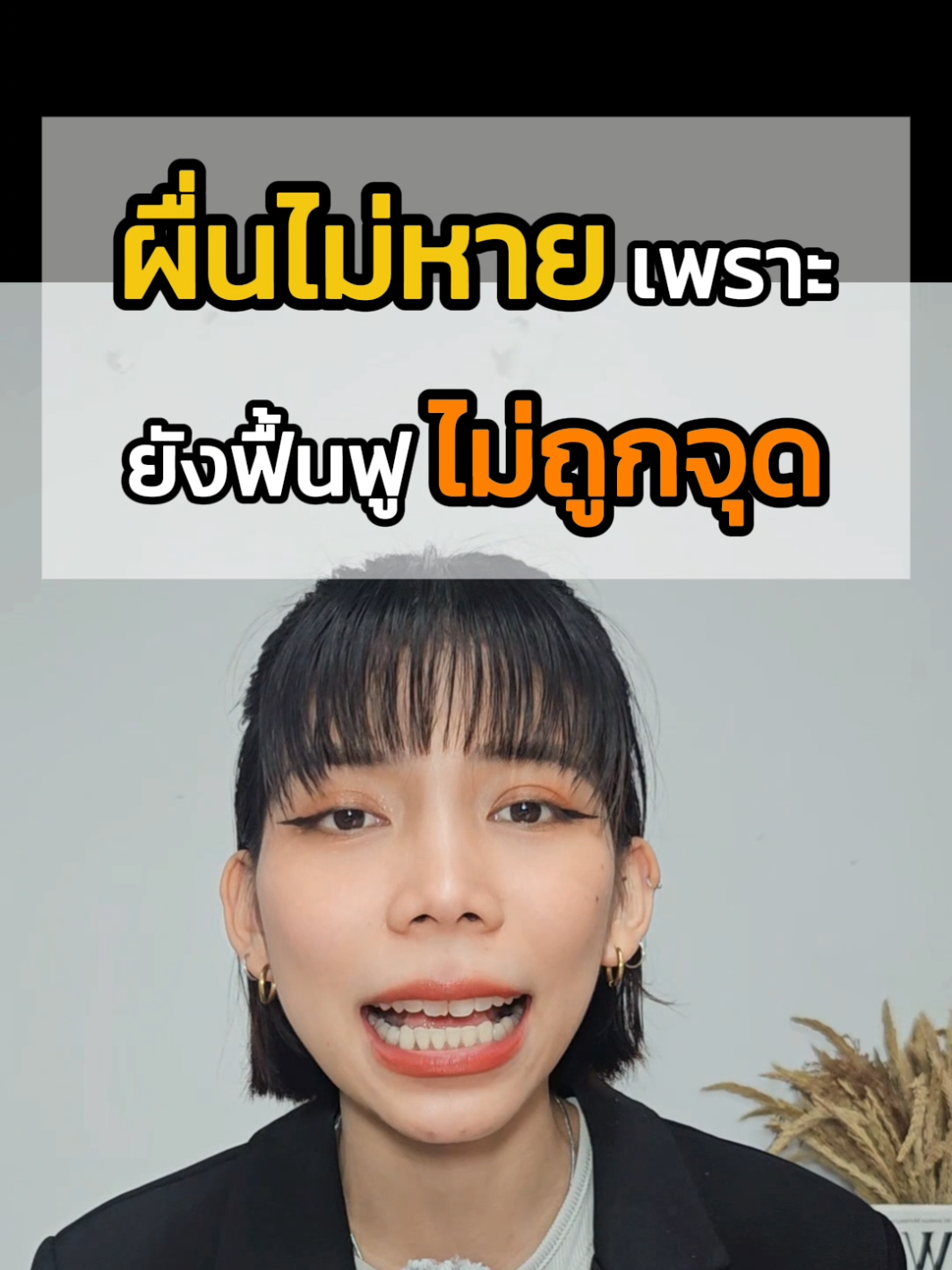ผื่นคัน​ไม่​หาย​เพราฟื้นฟู​ไม้ถูกจุด 🐽😱 #สะเก็ดเงิน #หวายดูแลสะเก็ดเงิน #อาการสะเก็ดเงิน #วิธีดูแลสะเก็ดเงิน #ฟื้นฟูสะเก็ดเงิน 
