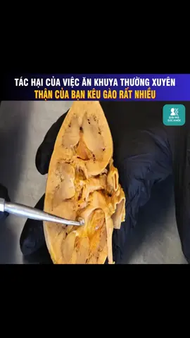 Tác hại của việc thường xuyên ăn khuya. Thận của bạn kêu gào rất nhiều #GiảiMãSứcKhỏe #GiảiMãCơThể #ĂnKhuyaHạiThận #ThậnKêuCứu #ThóiQuenĂnUống #HiểuCơThểMình #SứcKhỏeTiêuHóa #SứcKhỏeThận #KhoaHọcVui #GiảiMãKhoaHọc #BodyInside #HealthyVietnam #TheHealthLab #SốngKhỏeMỗiNgày #ĂnKhuyaCóHại