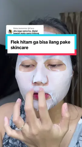 Membalas @@Caca gpp punya flek! Jaga aja biar ga makin bertambah, Flek hitam ga bisa ilang pake skincare