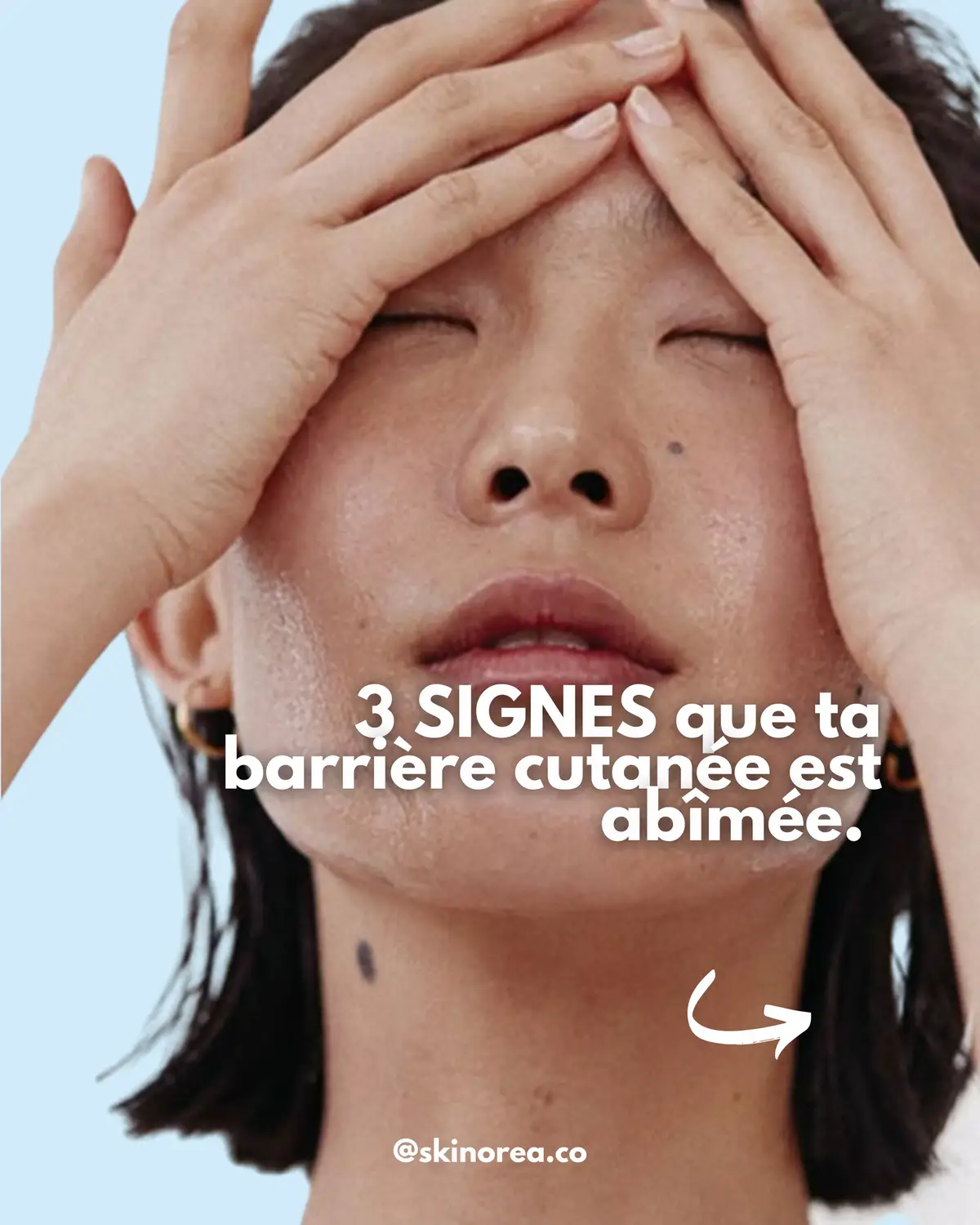 3 signes que ta barrière cutanée est abîmée en cet hiver ❄️  Les produits recommandés :  SKIN1004 Madagascar Centella Ampoule Anua PDRN Hyaluronic Acid Capsule 100 Serum RNW Ceramide Plus Ampoule Produits skincare coréens DISPONIBLES sur skinorea.com ················· SKINOREA • 스키노레아 Korean skincare shop 🛍️ 🔗 www.skinorea.com 📦 1-2 jours livraison en FR 🏝️ Livraison EU & DOM-TOM 💐 Échantillons offerts #kbeauty #skinorea #skincarecorenne#NovoDoveCabelos 