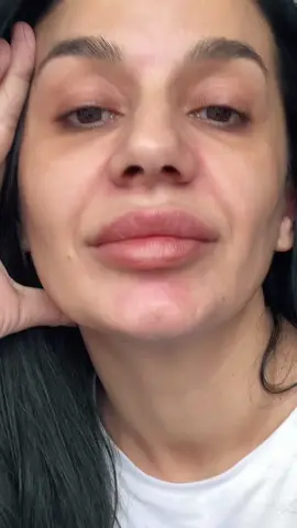 #repede #negrabim #tirtir 