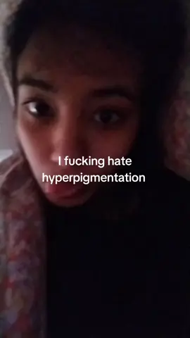 no makeup morning face  reveal I guess I'm aware I'm a catfish 😔 #desi #hyperpigmentationtips  #skincareadvice  #agnostic #07 