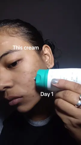 This cream BF @PURITO SEOUL #Purito #PanthenolCream #RealPostAcneCream #Koreanskincare #clearskin 