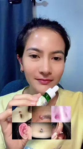 #ฟีด #fypシ゚ #นายหน้าtiktokshop #ลดบวมเจาะหู #บั๊มพ์หลังเจาะ 